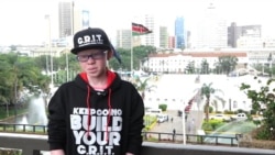 Kenya Albino Student