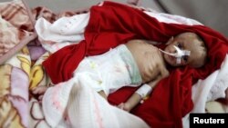 Un garçon souffrant de malnutrition à l’hôpital al-Sabeen à Sanaa, au Yémen, le 10 septembre 2018.
