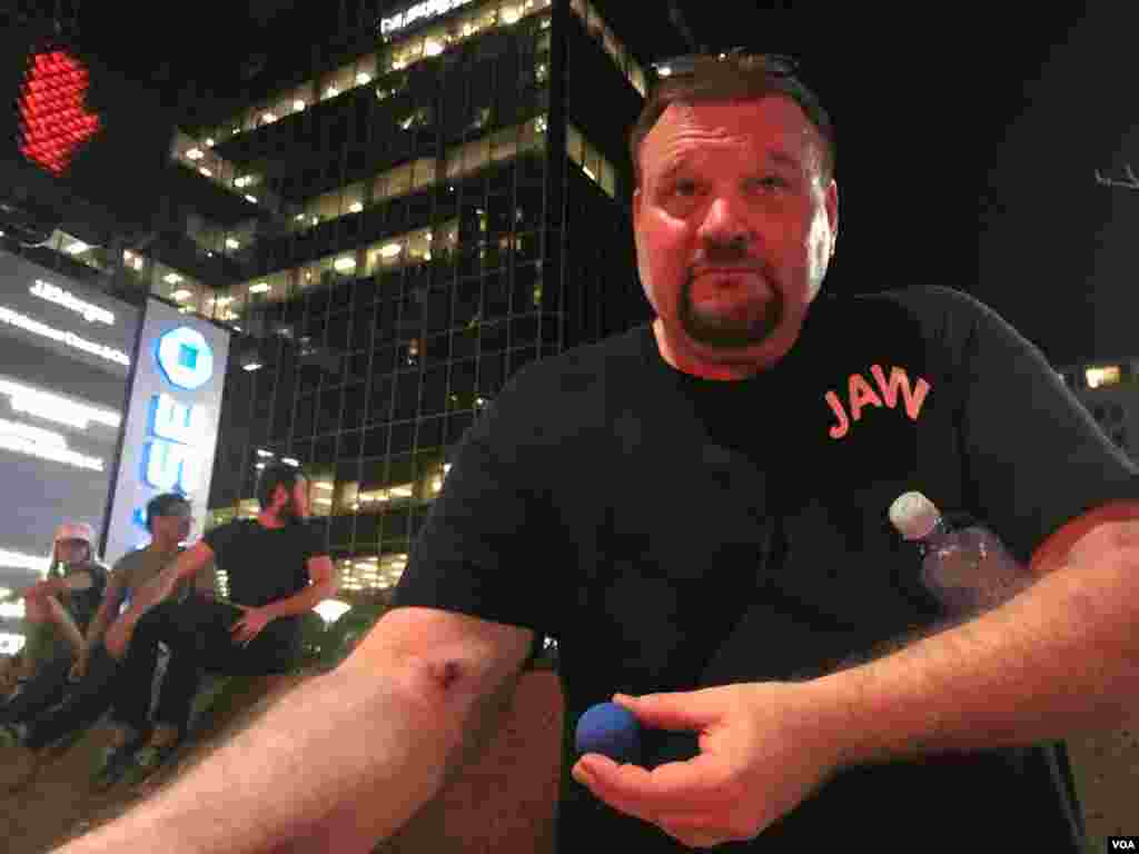 James Wellman shows VOA the injury he suffered after a rubber bullet hit his arm. He is a Trump supporter who came to see the speech. He wasn&#39;t able to get inside but decided to stay around. (Photo: Celia Mendoza / VOA)