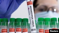 The monkeypox virus is usually found in West Africa but it has now been found in Europe, North America and Australia. Health experts believe it is being spread by close skin contact among people having sex. (REUTERS/Dado Ruvic/Illustration)