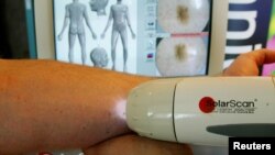 SolaScan, a new device to detect skin cancer, is demonstrated at its launch in Sydney, Australia, May 7, 2002.