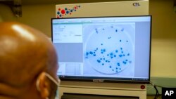德班的非洲健康研究院研究人员赛勒2021年12月15日在研究新型冠状病毒奥密克戎毒株