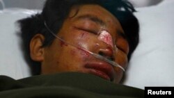 Dawa Tashi Sherpa in the Intensive Care Unit of Grandi International Hospital, Dhapasi, Kathmandu, April 18, 2014.