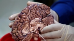 Quiz - Study: We Learn Language in Pre-Human Brain