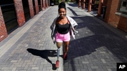 Claudine Humure, of Rwanda, walks with her new prosthetic leg at Next Step Bionics & Prosthetics, Monday, Sept. 20, 2021, in Newton, Mass. Humure was orphaned during her country's genocide and lost part of her leg to childhood cancer.