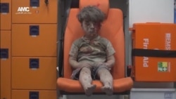 Haunting Photo, Video of Syrian Child Injured in Airstrike Goes Viral