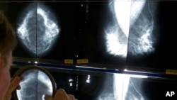 FILE - A radiologist uses a magnifying glass to check mammograms for breast cancer in Los Angeles.