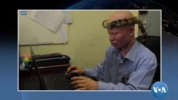 Maimouna Déné: "Le chemin est encore long" pour les albinos du Faso