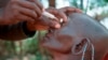 A doctor examines a trachoma patient in Ethiopia, Nov. 3, 2014.