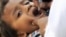 A child being vaccinated against polio in Rawalpindi, Pakistan.