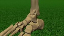 Carnet de santé : les blessures sportives