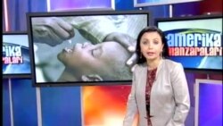 Falajga qarshi emlash/POLIO ANTI VACCINATION