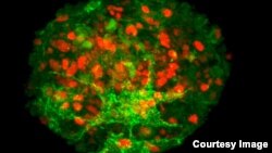 Spheres of cultured papillae cells from human hair follicles successfully produced new human hair when transplanted between the dermis and epidermis of human skin. (Claire Higgins/Christiano Lab at Columbia University Medical Center)