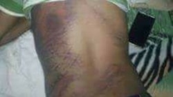 አድዋ ላይ በፖሊስና በወጣቶች መካከል ግጭት ተፈጥሮ ነበር