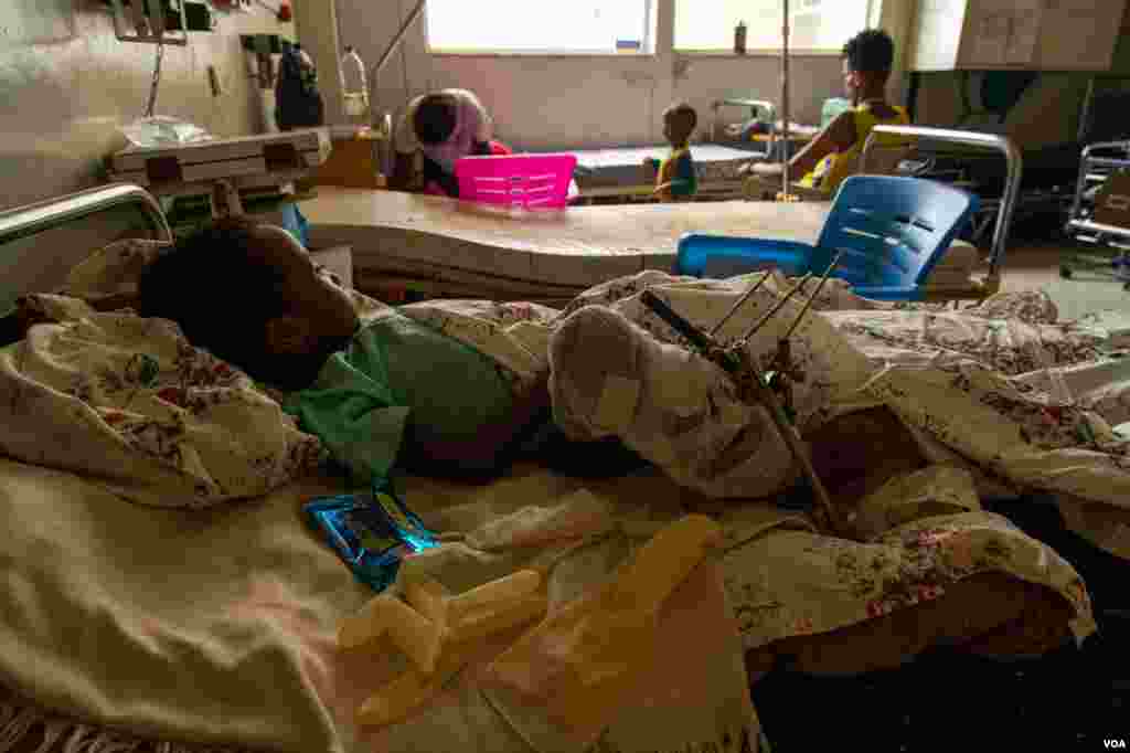 Samwarit, 4, recovers in a Mekelle, Ethiopia, hospital on June 4, 2021. She was knifed in the leg and shot in the hand, according to her father. 