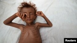 Seorang anak laki-laki malnutrisi terbaring di tempat tidur di luar gubuk keluarganya di distrik al-Tuhaita, provinsi Hudaydah, Yaman (26/9). (Reuters/Abduljabbar)
