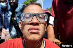 Seorang migran memulai mogok makan dengan menjahit mulutnya dalam aksi protes di luar kantor Institut Migrasi Nasional (INM) di Tapachula, Meksiko 15 Februari 2022. (REUTERS/Jose Torres)