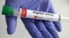 Foto illustrasi yang menunjukkan tabung tes yang dilabeli "positif virus mpox". (Foto: Reuters/Dado Ruvic)