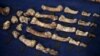 Researchers Claim Find of Early Human Ancestor