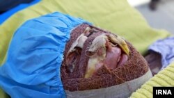 Süheyla Cövrkeş - İranda üzü turşu ilə yandırılan qadınlardan biri