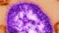 FILE - An undated electron microscope image of a measles virus particle.