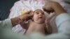 Study: Microcephaly Found in Older Babies Exposed to Zika