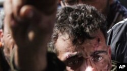 A wounded fighter is brought into a the Ras Lanuf Hospital from the battle in Bin Jawad on March 6, 2011.