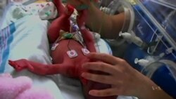 New Research May Hold Clues About Preterm Births