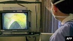 Kanker usus besar adalah salah satu jenis kanker yang paling mematikan. Namun jenis kanker ini seringkali tidak menunjukkan gejala di tahapan awal sehingga sulit untuk didiagnosa.