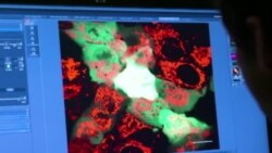 تازه های پزشکی در مورد بیماری پارکینسون