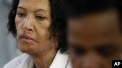 Nov Rey, 50, an acid attack victim, looks on as she waits to sing during a performance by traditional Cambodian musicians, file photo. 