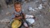 UN Gives Record-setting Emergency Aid Funds to Yemen 