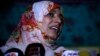 Yemeni Nobel Peace Prize Winner Barred from Entering Egypt