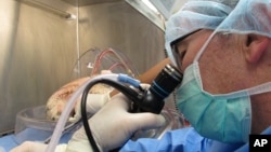 FILE - Dr. Thomas Egan uses a scope to examine donated lungs in his lab at the University of North Carolina, Chapel Hill, Nov. 15, 2013.