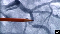 Numerous studies show that cold water fish --salmon, tuna and other oily fish -- contain omega-3 fatty acids can decrease the risk of coronary artery disease