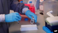 រូបឯកសារ៖ អ្នកបច្ចេកទេសស្រាវជ្រាវលោក Jess O'Hara កំពុង​ដំណើរការ​ធ្វើតេស្ត​អង្គបដិប្រាណ​ដើម្បី​ឲ្យ​ដឹង​ថា តើ​ពួកវា​ជាប់​ទៅ​នឹង​វីរុស​ដែរ​ឬ​ទេ ដោយ​លោក​ធ្វើតេស្ត​នេះ នៅក្នុង​មន្ទីរពិសោធន៍​នៅ​មហា​វិទ្យាល័យ Imperial College ក្នុង​ទីក្រុងឡុងដ៍ កាលពី​ថ្ងៃទី៣០ ខែកក្កដា ឆ្នាំ២០២០។