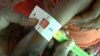 Aid Groups in Bangladesh Take On Rohingya Child Malnutrition