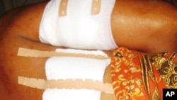 កម្មករ​បី​នាក់​ត្រូវ​បាញ់​ឱ្យ​របួស​ក្នុង​ការ​តវ៉ា​រឿង​ប្រាក់​ឈ្នួល​ពលកម្ម។