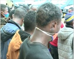 A freed hostage with a ear chopped off, in Bamenda, Apr. 19, 2021. (Moki Edwin Kindzeka/VOA)