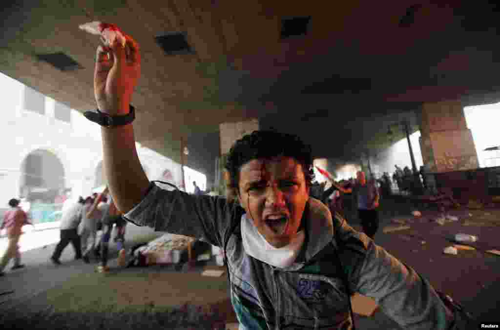 A member of the Muslim Brotherhood and supporter of ousted Egyptian President Mohamed Morsi shouts slogans after he is injured in front Azbkya police station during clashes at Ramses Square, Cairo, August 16, 2013. 