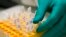 A researcher prepares DNA in a laboratory at the Bioaster Technology Research Institute in Lyon
