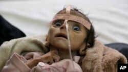 Infant Udai Faisal, who died from acute malnutrition on March 24, is one of thousands of Yemeni children who are suffering from hunger as one of the most horrific consequence of the Yemeni conflict and the naval blockade and airstrikes by the Saudi-led co