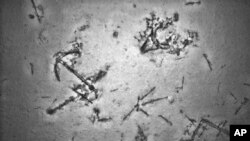 In this photo provided on Wednesday, May 13, 2015, by the Australian Transport Safety Bureau, debris from a shipwreck lays on the Indian Ocean floor, nearly 4 kilometers (2.5 miles) below the surface, off the west coast of Australia.