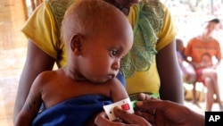 Le bras d'un enfant est mesuré dans un centre mis en place par le Programme alimentaire mondial et Action contre la faim, dans le village de Beraketa, à l'extrême sud de Madagascar le 12 novembre 2020.