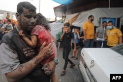 Seorang pria Palestina dan seorang anak perempuan yang terluka tiba di rumah sakit Al-Shifa di Kota Gaza setelah serangan Israel hari Minggu, 29 Oktober 2023.
