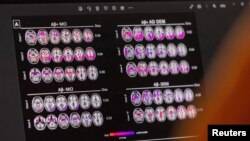 تصاویر اسکن مغز. آرشیو