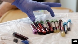 Echantillons de sang prélevés sur un patient au Centre de Recherche sur le Cancer Fred Hutchinson à Seattle.