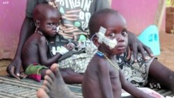 Researchers: Human Toll Of South Sudan War 'As Bad As Iraq or Syria'
