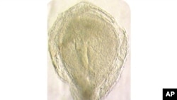 This image from Oxford University shows a human embryo 16-19 days after fertilization. The embryo is undergoing a process called gastrulation, when different cell types are generated and distributed to specific places in the embryo. (University of Oxford via AP)