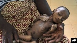 Seorang bayi menderita malnutrisi akut akibat merebaknya wabah Covid-19, dirawat di sebuah rumah sakit kota Hounde, provinsi Tuy, Burkina Faso (foto: dok).